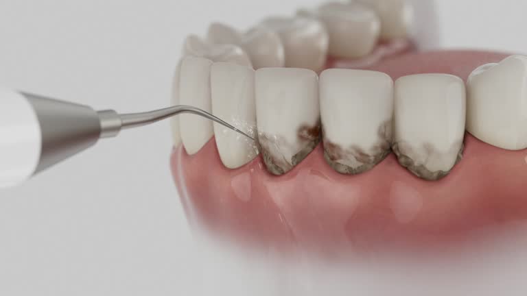 Reliable Dental Implants contractor in Ammon, ID by Smile Center Dentistry